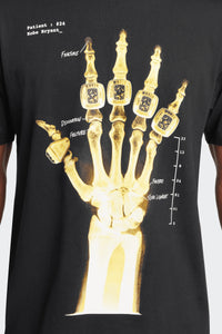 KOBE X-RAY TEE