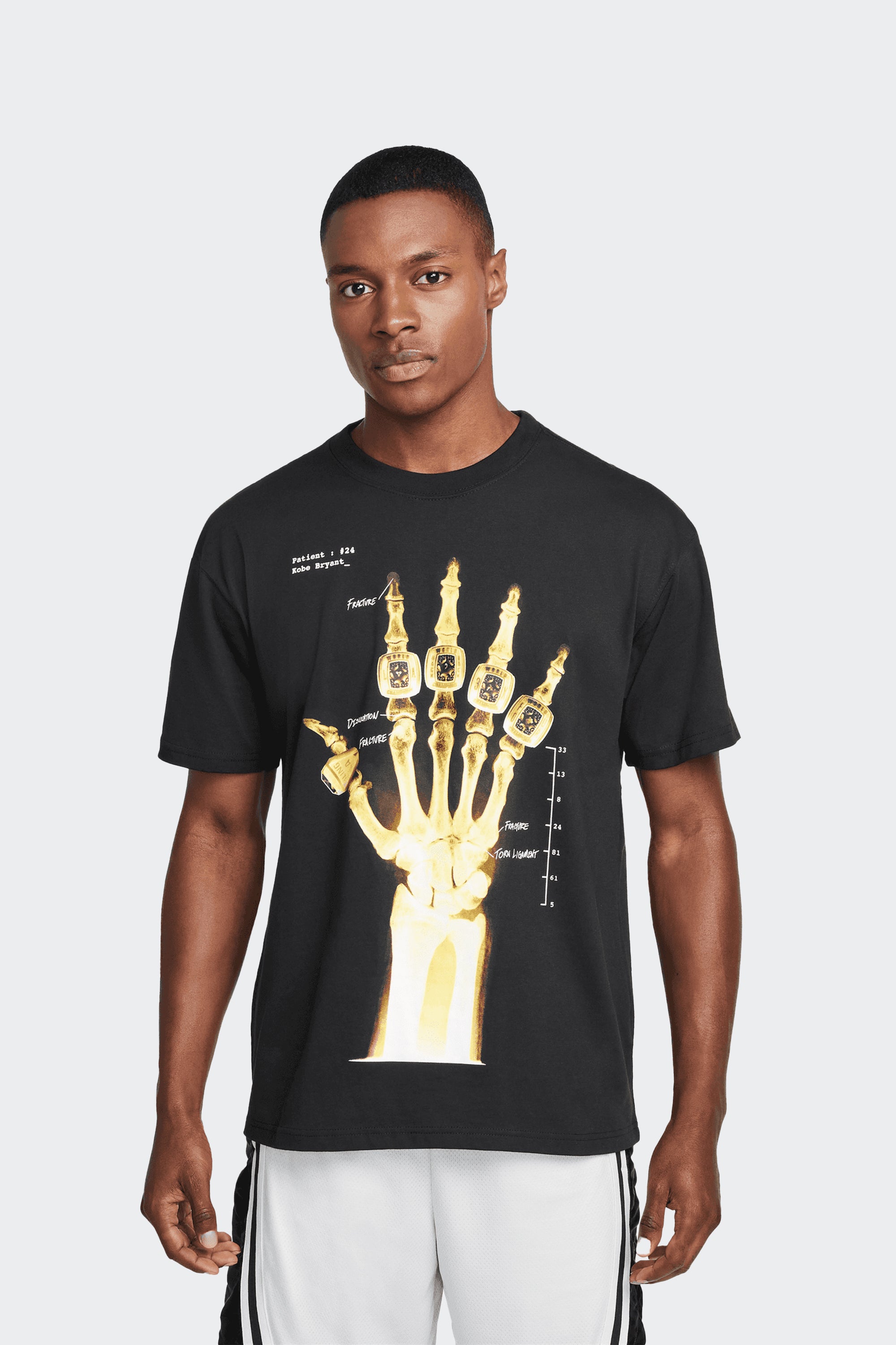 KOBE X-RAY TEE – Sesinko
